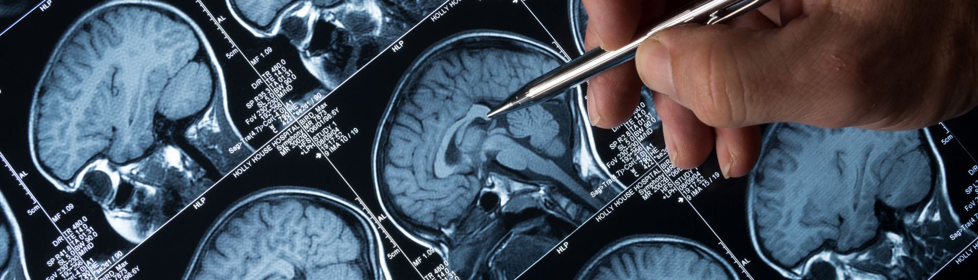 MRI brain images